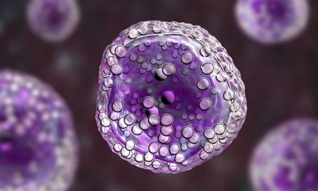 ANMAT aprobó un innovador tratamiento para un cáncer de sangre. ANMAT aprobó un innovador tratamiento para un cáncer de sangre.