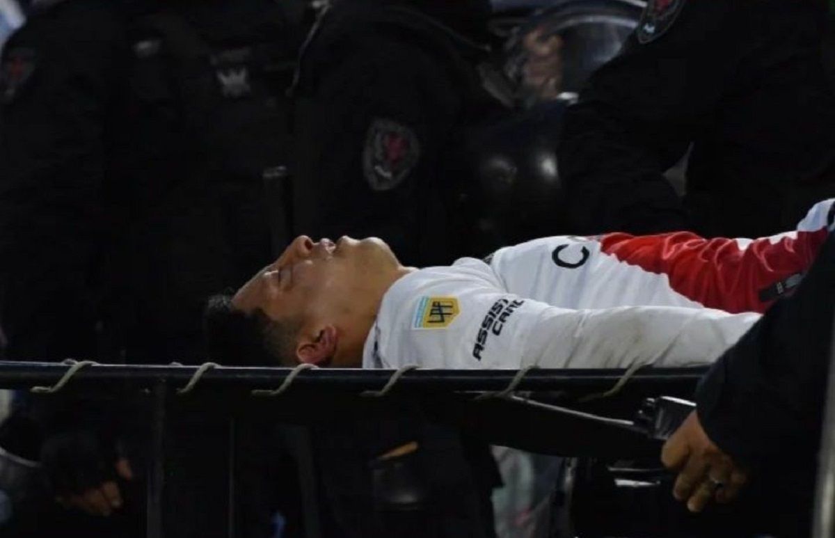 Rodrigo Aliendro se retiró golpeado del superclásico y River informó que sufrió graves fracturas en su rostro