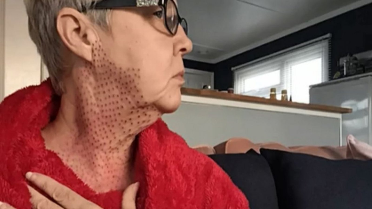 Jayne Bowman decidió demandar a la clínica por mala praxis.