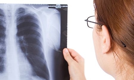 La tuberculosis se puede prevenir a través de la vacuna BCG y curar a través de la indicación de medicación específica. La tuberculosis se puede prevenir a través de la vacuna BCG y curar a través de la indicación de medicación específica.