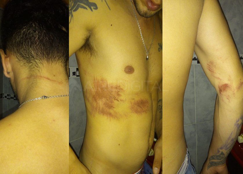 Policías golpearon y abusaron de una pareja gay