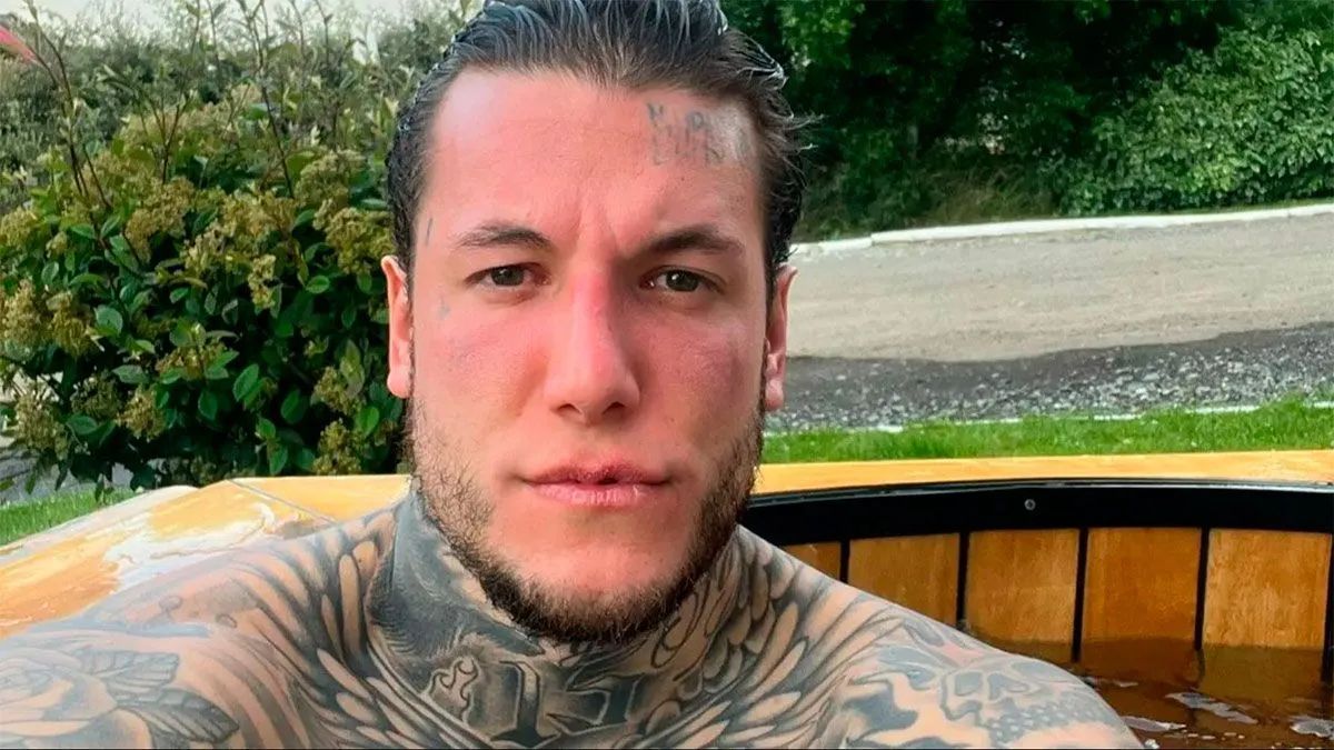 Alex Caniggia decidió someterse a un importante procedimiento estético.