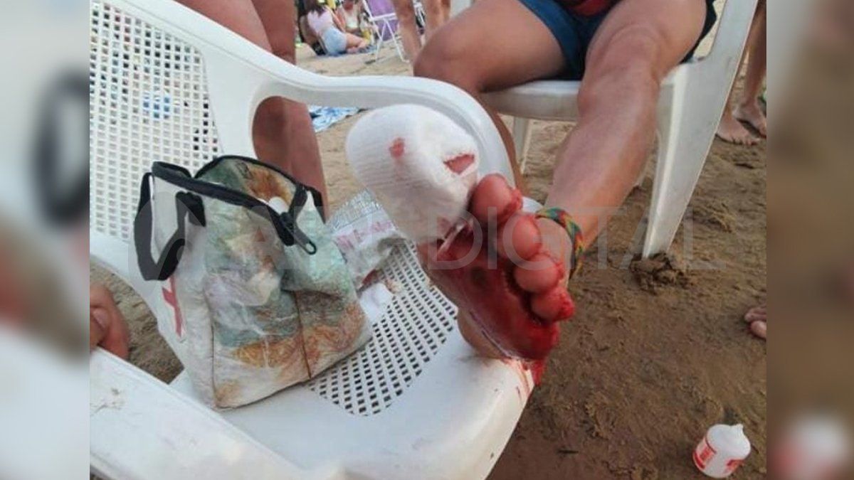 Durante el fin de semana largo una adolescente perdió un dedo y hubo más de 30 heridos por ataques de palometas en la Costanera Este.