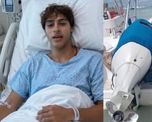 El participante permanece internado en Estados Unidos mientras continúa su proceso de recuperación. El participante permanece internado en Estados Unidos mientras continúa su proceso de recuperación.
