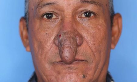 Pintaba una casa, le contó al dueño el calvario que sufría por su nariz y cambió su vida para siempre Pintaba una casa, le contó al dueño el calvario que sufría por su nariz y cambió su vida para siempre