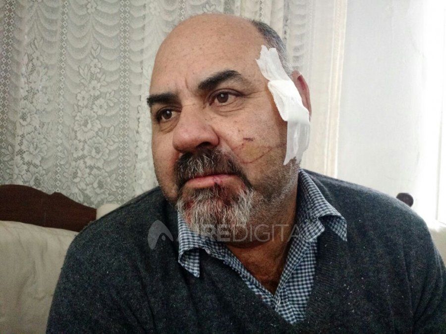 Violento robo a remisero: el ladrón se creía un ‘superhombre’