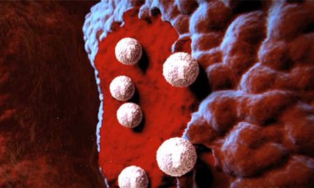 El nuevo tratamiento combina una inmunoterapia -el atezolizumab- con un anticuerpo monoclonal -el bevacizumab-. El nuevo tratamiento combina una inmunoterapia -el atezolizumab- con un anticuerpo monoclonal -el bevacizumab-.