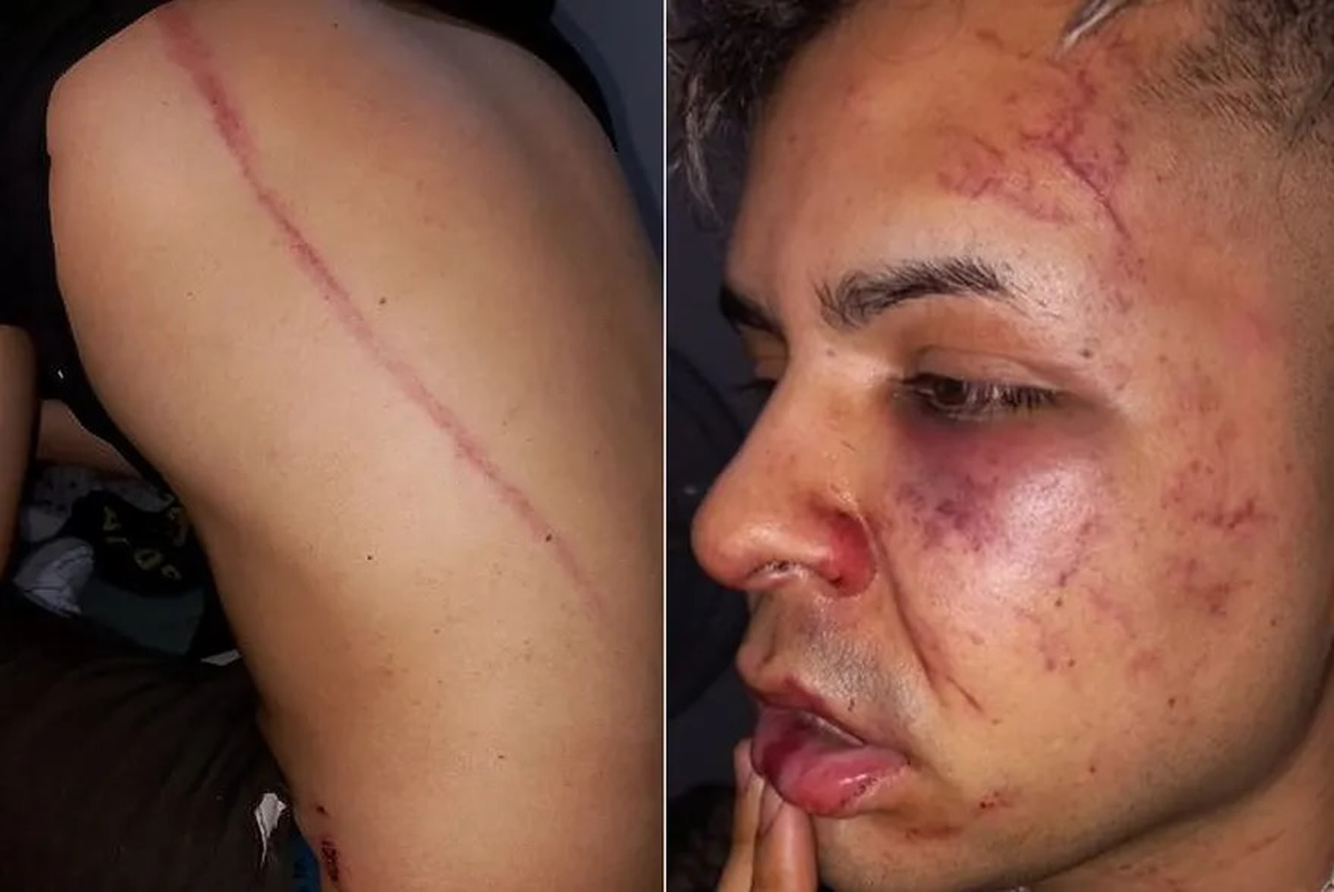 Patovicas atacaron a latigazos a una pareja en la puerta de un boliche en San Miguel de Tucumán