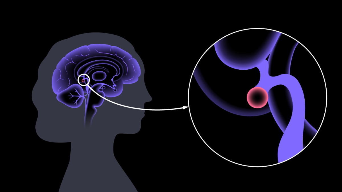 Activar la glándula pineal mejora el bienestar físico y mental, conectándonos con una mayor claridad. Activar la glándula pineal mejora el bienestar físico y mental, conectándonos con una mayor claridad.