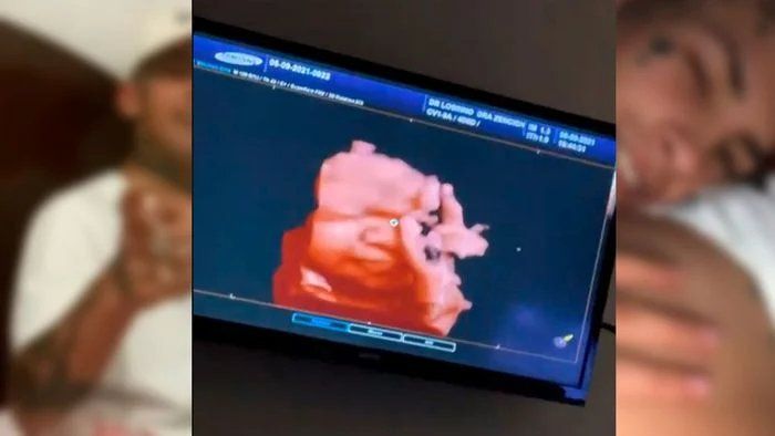 L-Gante había publicado fotos en sus redes mientras le realizaban una ecografía 5D a su pareja.