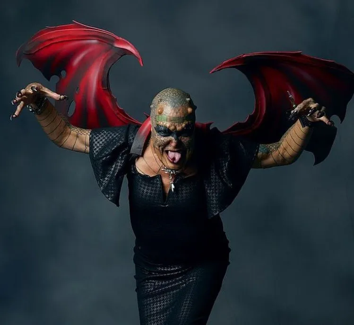 Extirparse los genitales es el último paso que Richard Hernández busca para transformarse en el primero