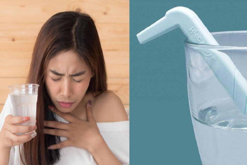 Científicos confirman que este dispositivo podría ser la cura para el hipo