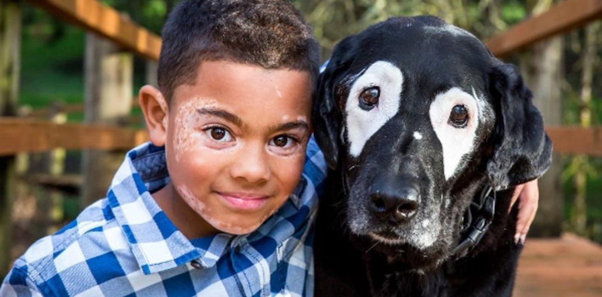 Un niño supera depresión al conocer un perro con su misma afección