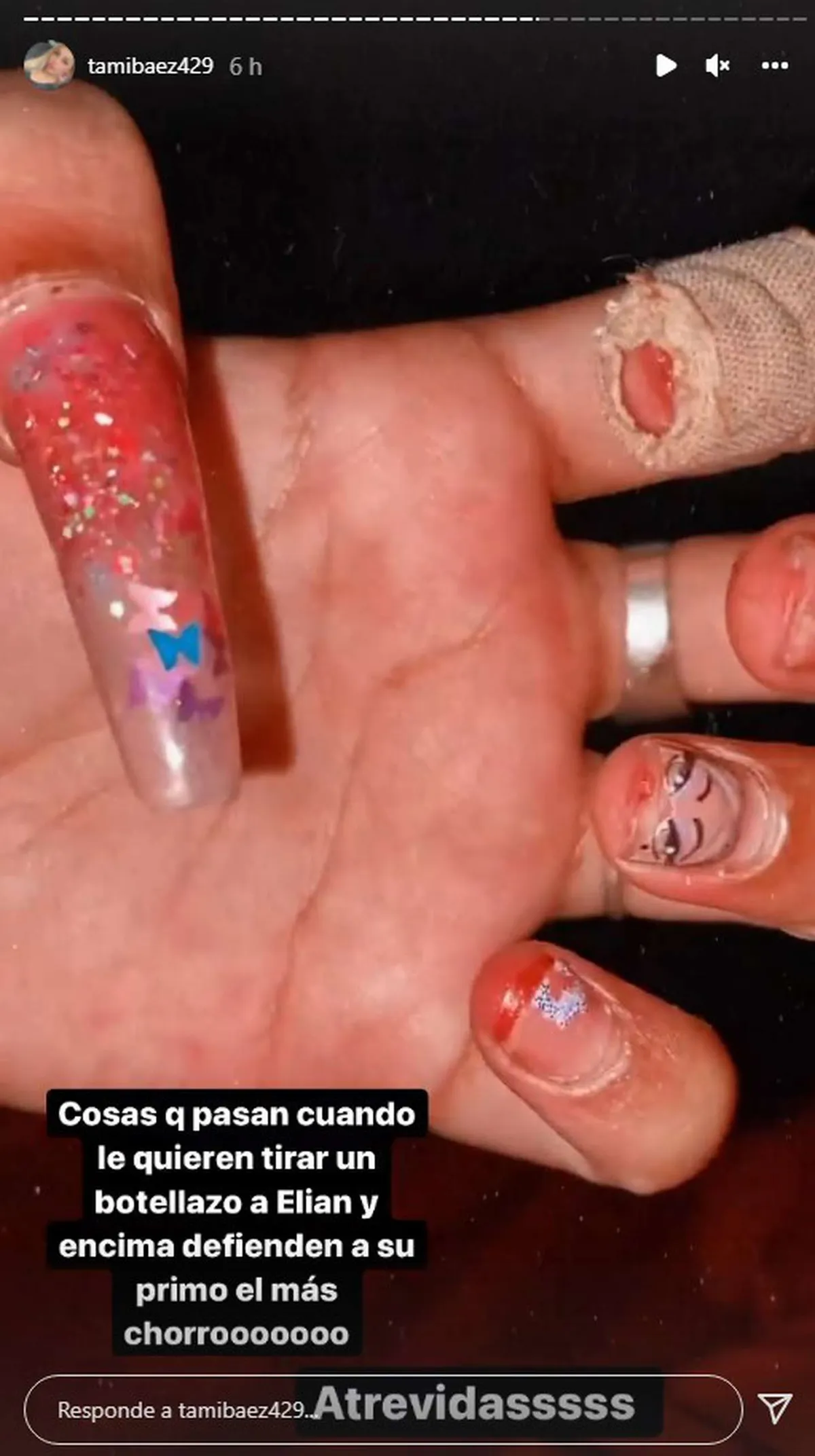 Le hackearon la cuenta a Tamara B&aacute;ez, la novia de L-Gante.