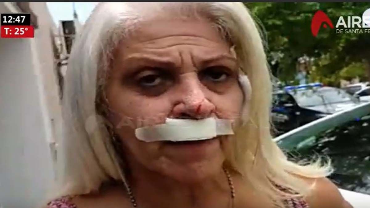 Violenta entradera en Guadalupe Oeste: Me rompieron la boca con un punzón, son mis vecinos