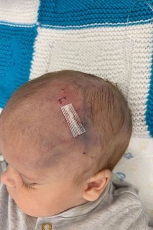 Los padres de Carson todavía están esperando saber cuánto daño le hicieron a su hijo ( Imagen: Leeds Live WS)