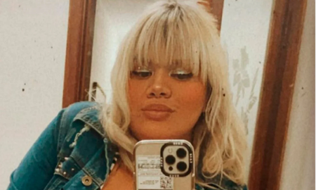 Morena Rial reveló si le quedaron cicatrices tras sus múltiples cirugías estéticas Morena Rial reveló si le quedaron cicatrices tras sus múltiples cirugías estéticas