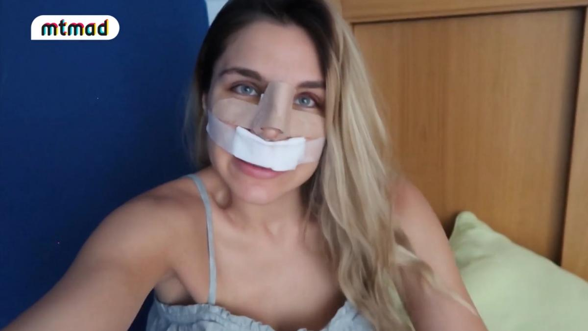 Ivana Icardi se operó la nariz.