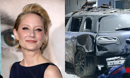 Anne Heche chocó contra una casa y provocó un incendio: está hospitalizada en grave estado Anne Heche chocó contra una casa y provocó un incendio: está hospitalizada en grave estado