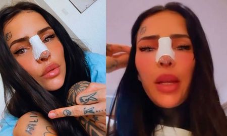 Cande Tinelli mostró cómo le quedó la nariz post cirugía plástica. Cande Tinelli mostró cómo le quedó la nariz post cirugía plástica.