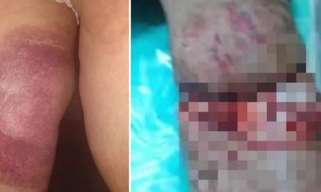 terror en un tobogan de agua: se rompio y una pareja termino con serias lesiones terror en un tobogan de agua: se rompio y una pareja termino con serias lesiones