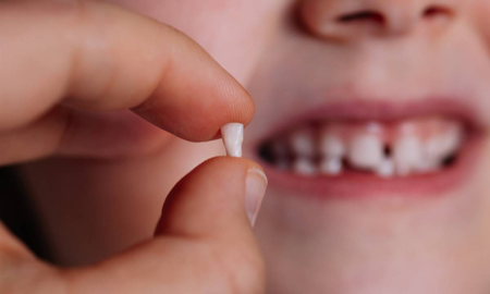 El llamativo significado de soñar con que se te caen los dientes El llamativo significado de soñar con que se te caen los dientes