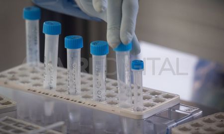 Covid-19: subvariantes BA4 y BA5 de Ómicron tienen la mayor capacidad de evasión a la inmunidad por vacunas. Covid-19: subvariantes BA4 y BA5 de Ómicron tienen la mayor capacidad de evasión a la inmunidad por vacunas.