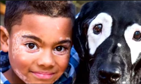 Día Mundial del Vitiligo: qué es y cuáles famosos aprendieron a vivir con la enfermedad