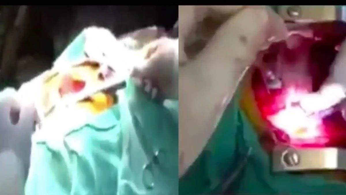 Cirug&iacute;a&nbsp;a coraz&oacute;n abierto en M&eacute;xico