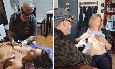 Diego Staropoli lleva más de 15 años reconstruyendo areolas mamarias de forma gratuita a mujeres que superaron el cáncer de mama. Diego Staropoli lleva más de 15 años reconstruyendo areolas mamarias de forma gratuita a mujeres que superaron el cáncer de mama.