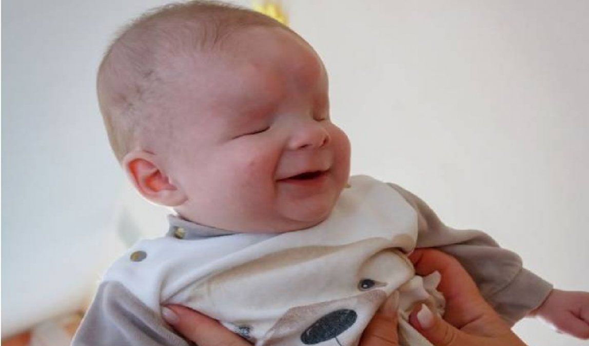 El bebé que nació sin ojos fue adoptado y no para de sonreír