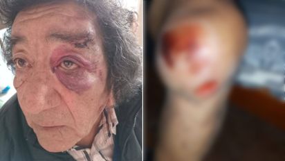 Tito Frías, referente de la cumbia santafesina, busca testigos tras ser atropellado por un auto que huyó