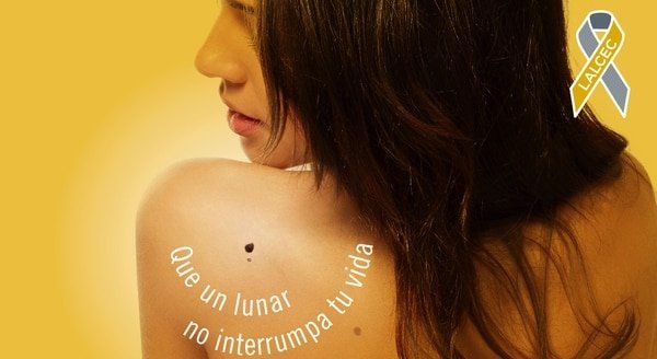 Cómo hacer un efectivo control de los lunares