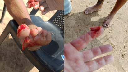 Alerta por ataques de palometas en la Laguna Setúbal: qué son, por qué muerden y cómo prevenirlos