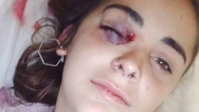 Así quedó Nerina tras el ataque