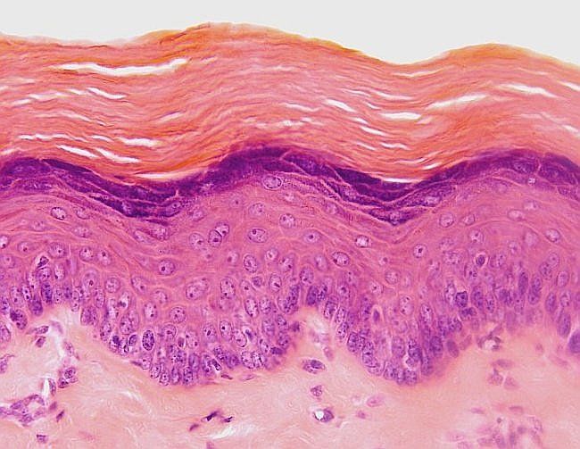 piel vista al microscopio.jpg