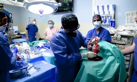 El hombre no era apto para un trasplante de corazón humano. El hombre no era apto para un trasplante de corazón humano.