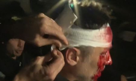 El periodista Cristian Mercante fue herido con un objeto contundente. El periodista Cristian Mercante fue herido con un objeto contundente.