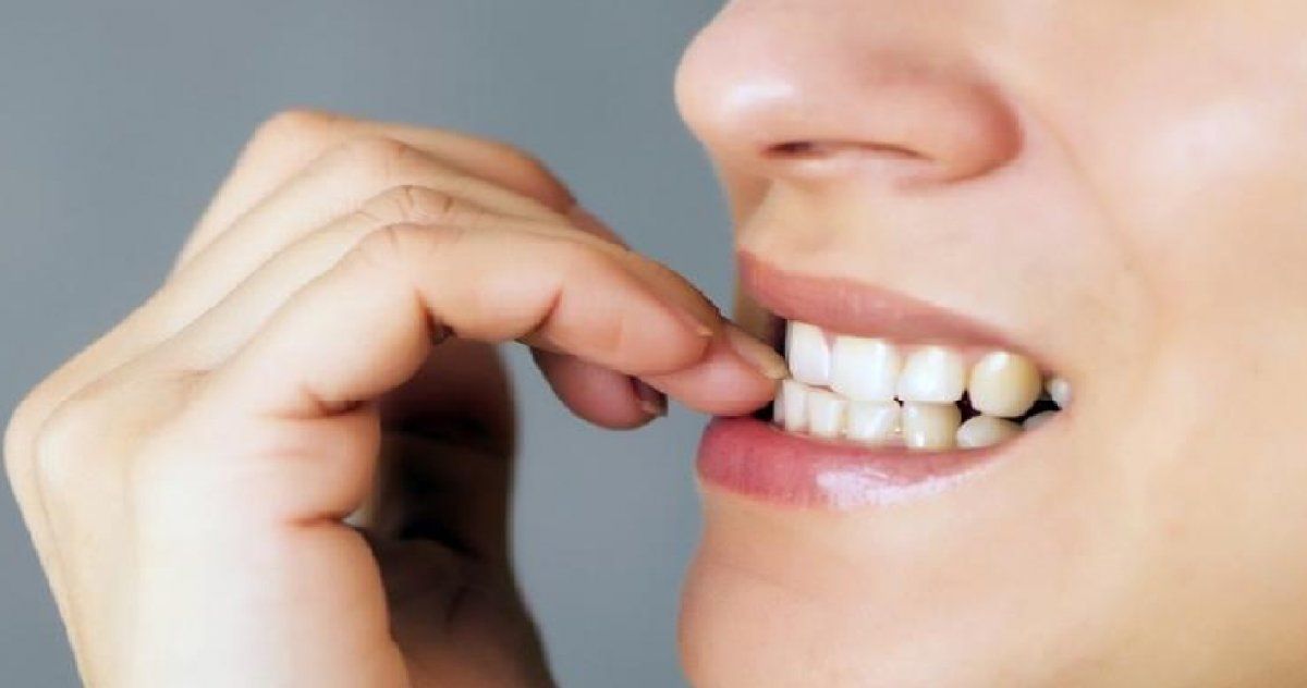 Superar el hábito de comerse las uñas puede requerir tiempo y paciencia