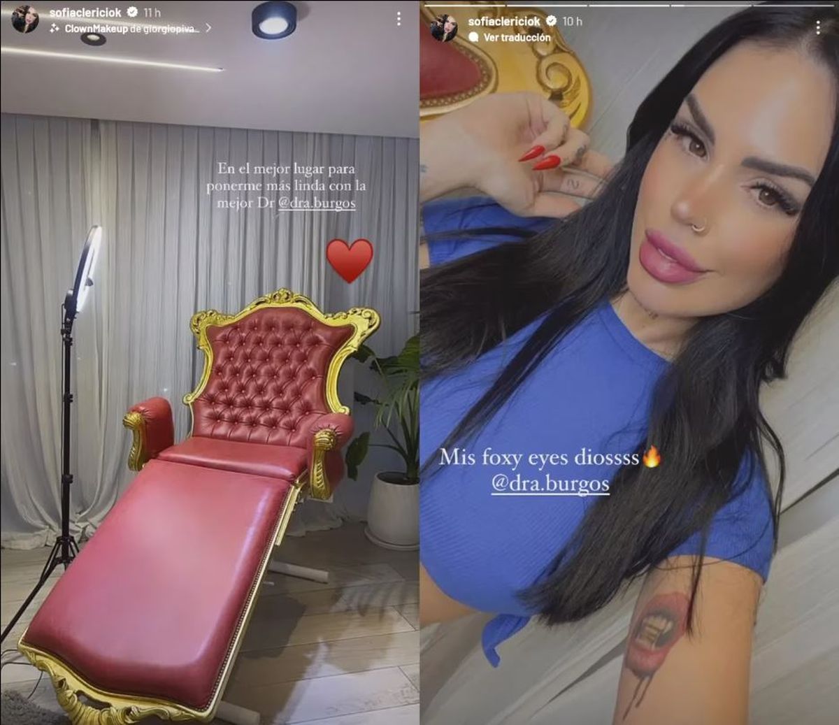 Sofía Clerici se hizo nuevos tratamientos estéticos. Sofía Clerici se hizo nuevos tratamientos estéticos.