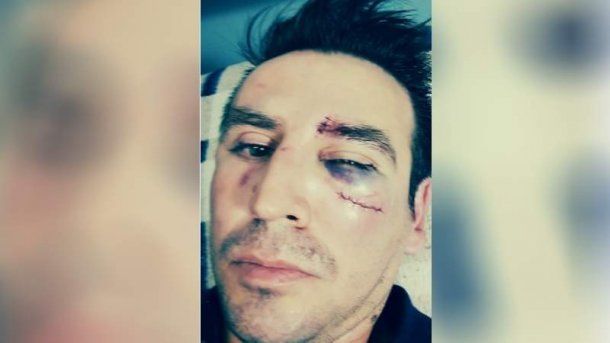 San Juan: un papá atacó a golpes a un preceptor acusado de abusar de su hija