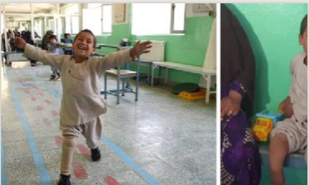 La emotiva reacción de un niño al recibir la prótesis de su pierna y bailar por primera vez