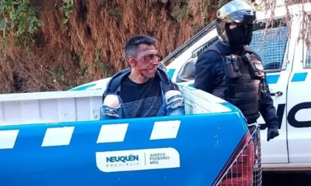 Neuquén: intentó robar en una casa, los vecinos lo atraparon y lo lincharon Neuquén: intentó robar en una casa, los vecinos lo atraparon y lo lincharon