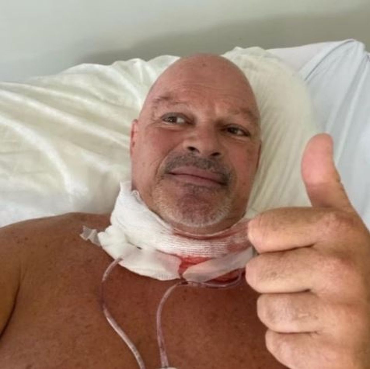 Alfa se sometió a una delicada operación en 2019. Alfa se sometió a una delicada operación en 2019.