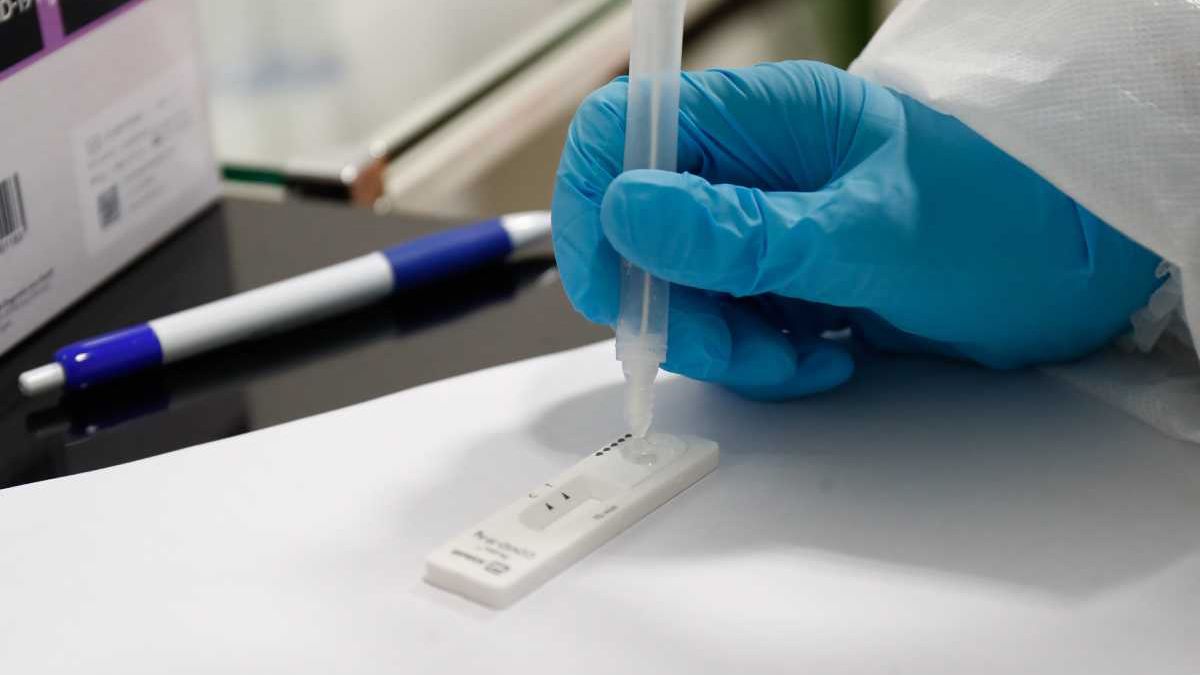 Este tipo de pruebas no reemplazan el diagnóstico de la infección por coronavirus mediante la detección del ácido nucleico del virus