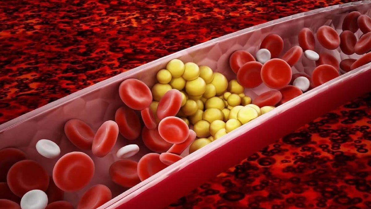 Los mejores alimentos para bajar los triglicéridos durante el desayuno