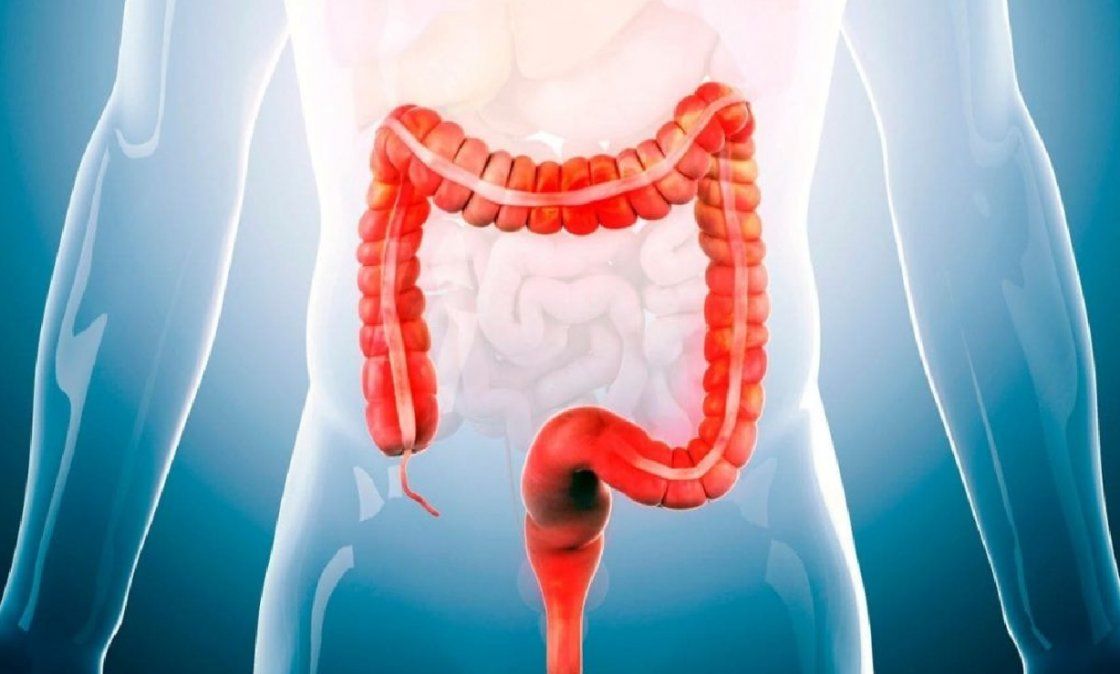 Contraindicaciones de consumir en exceso carne roja para la salud