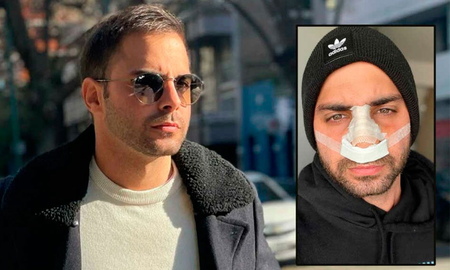 El instagramer, Grego Rossello, mostró cómo le quedó la nariz en Instagram y contó detalles de su internación en una clínica. El instagramer, Grego Rossello, mostró cómo le quedó la nariz en Instagram y contó detalles de su internación en una clínica.