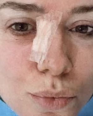 La periodista pidió tomar conciencia sobre la prevención y recomendó realizar controles dermatológicos dos veces por año. La periodista pidió tomar conciencia sobre la prevención y recomendó realizar controles dermatológicos dos veces por año.