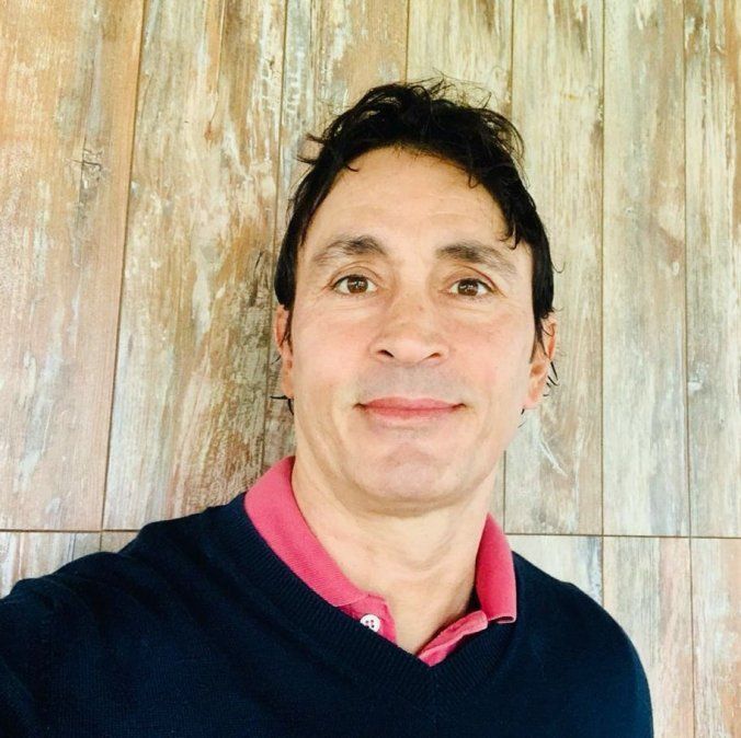 El actor mostró cómo quedó tras sanar de sus quemaduras.